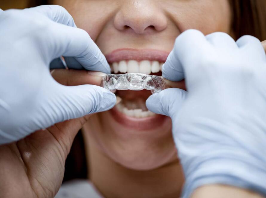 Invisible Braces