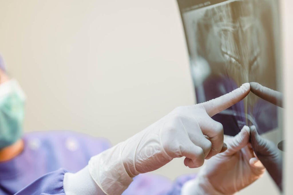 The dentist is looking at the patient's dental x-ray results for an effective treatment and improves the patient's dental health and a bright smile.