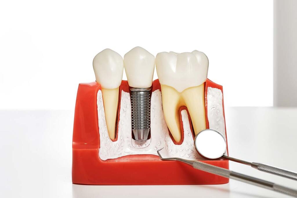 Dental prosthetics, close-up. Mouth mirror near of an anatomical model of jaw